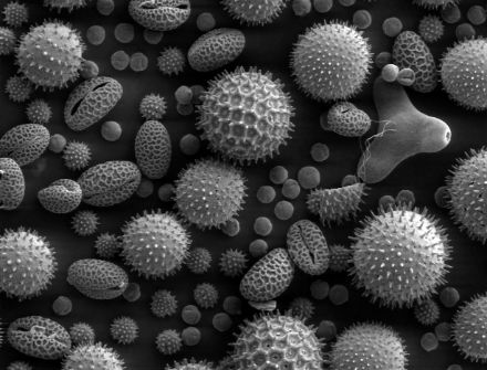 Image de grains de pollen au microscope électronique à balayage.
